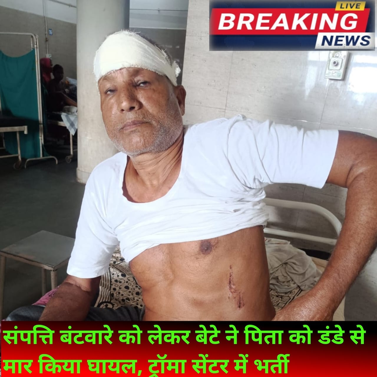 संपत्ति बंटवारे को लेकर बेटे ने पिता को डंडे से मार किया घायल, ट्रॉमा सेंटर में भर्ती
